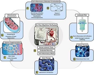 Pushing the boundaries of innovation: the potential of ex vivo organ perfusion from an interdisciplinary point of view